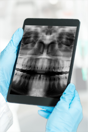 Dentist Looking At Patients Teeth Xray