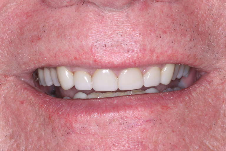 J Bucchanan After