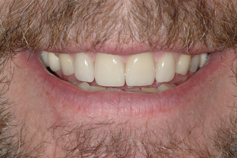 J Potter After